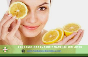 Cómo usar el limón para el acné